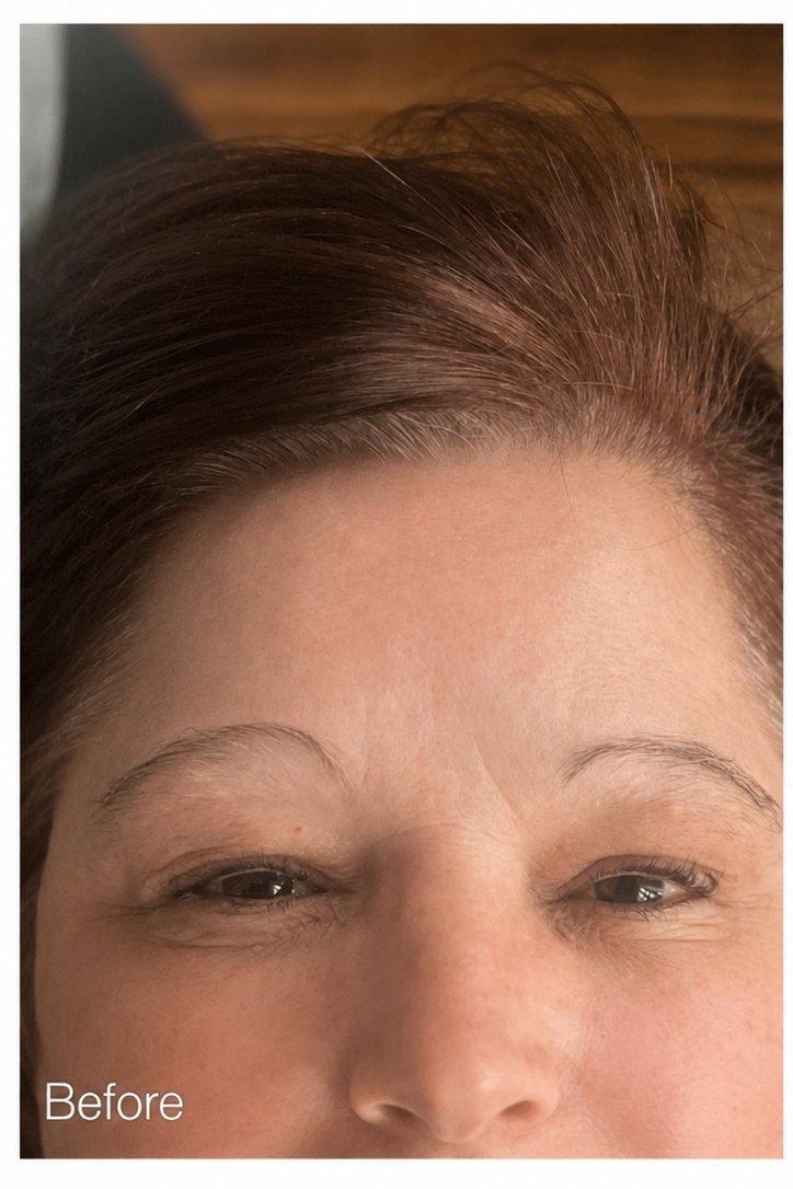 Forever Brows — before